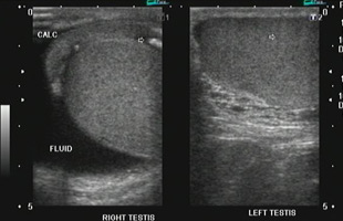 Testicular ultrasound scanning A S Services